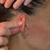 ASMR Spa Deluxe Ear Massage With Oil Thunderstorm Background Sounds No Talking