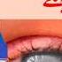 Reverse Cataracts Glaucoma Naturally With This Daily Fermented Antioxidant Shake Magic Eye Drops