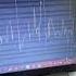 Perfectly Normal Vocaloid Tuning Vocaloid Cover Shortvideo