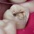 Dentist Looking Tooth Cavity Dentist Satisfying