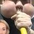 Doctor Reacts To Blowers Disease