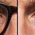 How To Reverse Poor Eyesight Naturally Top 3 Eye Exercises To Improve Vision